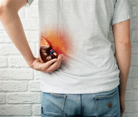 Dolore ai Reni (Male ai Reni): Cosa Può Essere e Cosa Fare.